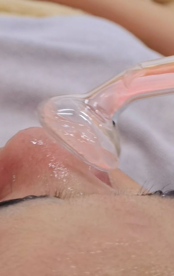 OxyClear HF Treatment